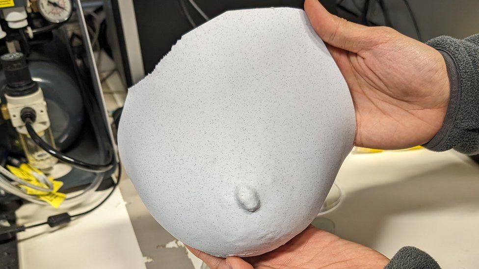 东安格利亚大学 (UEA) 的研究人员:3D打印可提高乳房再造手术效率
