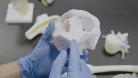 Stratasys 和Ricoh启动骨科肿瘤3D打印模型临床研究