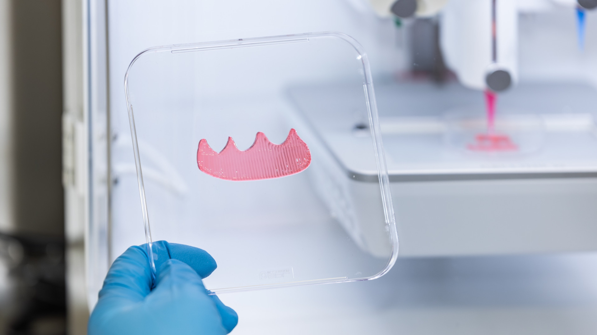新加坡国立大学研究人员开发出人工智能增强型3D生物打印牙龈移植的新方法